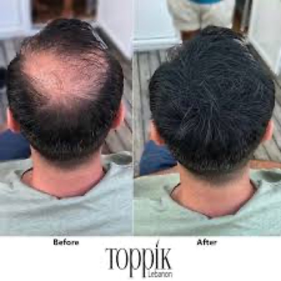 Keratin hair building fibers set of 3 all colors available - Picture 5 of 10